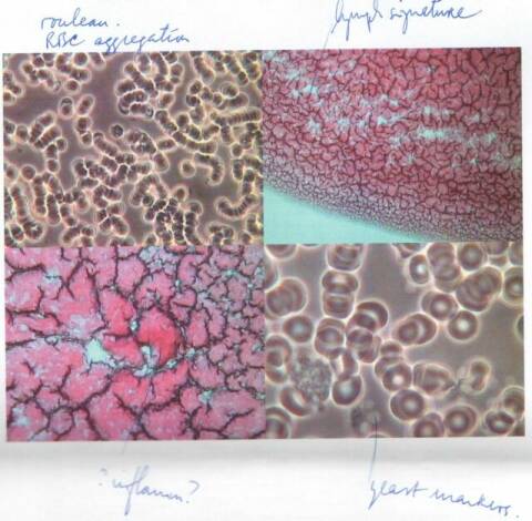 First live blood analysis results