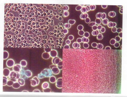 Final live blood analysis results